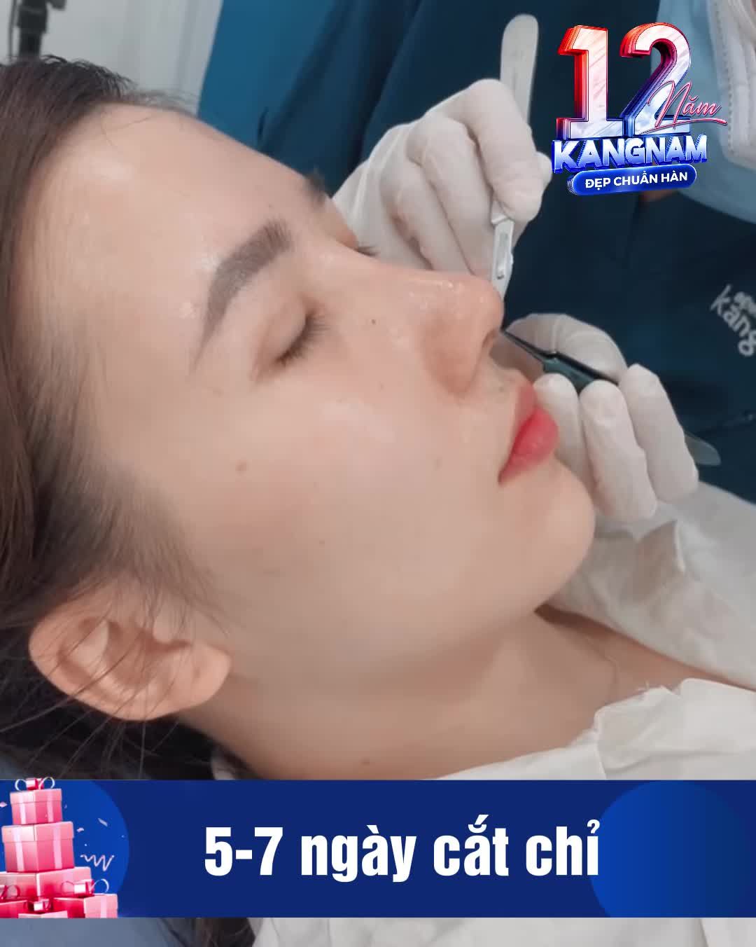 Mới 7 ngày cắt chỉ, dáng mũi đã quá chất lượng rồi